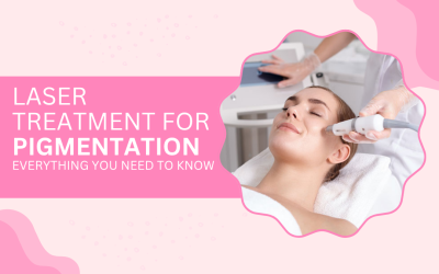 Laser Treatment for Pigmentation — Everything You Need to Know