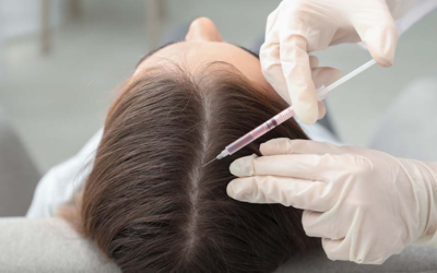 Medical professional in gloves injects a syringe into a patient’s scalp during a treatment.
