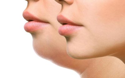 Close-up of two side-profile faces, left with a fuller chin and right with a slimmer jawline.