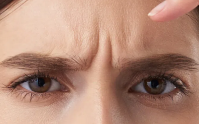 Close-up of a person’s brow furrowed in a frown with a finger resting on the forehead, showing wrinkles between the eyebrows (frustration/concentration).