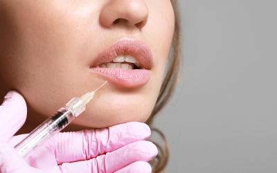 Close-up of a clinician injecting lip filler into a woman's lips, with a gloved hand holding a syringe.