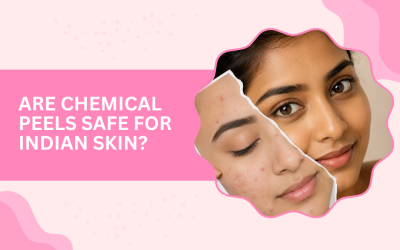 Are Chemical Peels Safe for Indian Skin?
