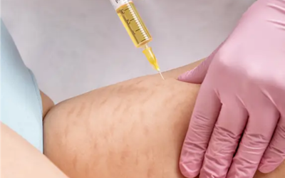Medical professional wearing pink gloves administers an injection into a patient’s upper arm.