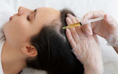 Person lying back while a gloved clinician injects medicine into their scalp with a syringe.