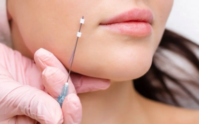 Close-up of a clinician with gloved hands preparing to inject a patient’s jawline with a small needle for a facial procedure.