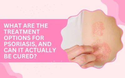 What Are the Treatment Options for Psoriasis, and Can It Actually Be Cured?